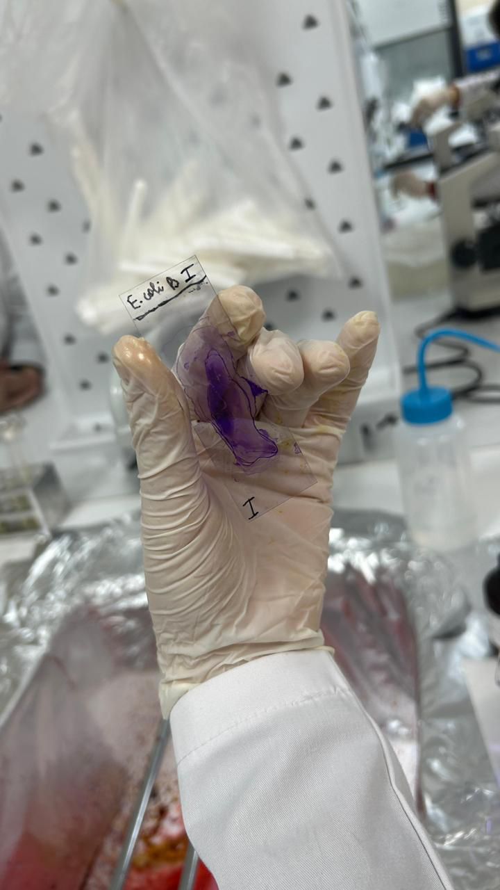 E. coli nümunəsi